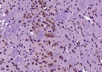 ErbB4 Rabbit Polyclonal Antibody