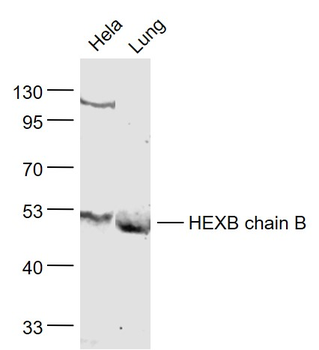 HEXB chain B Rabbit Polyclonal Antibody