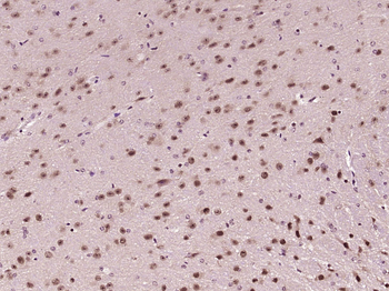 RAD23B Rabbit Polyclonal Antibody