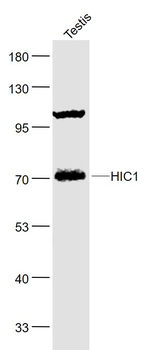 HIC1 Rabbit Polyclonal Antibody