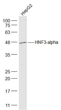 HNF3-alpha/FOXA1 Rabbit Polyclonal Antibody