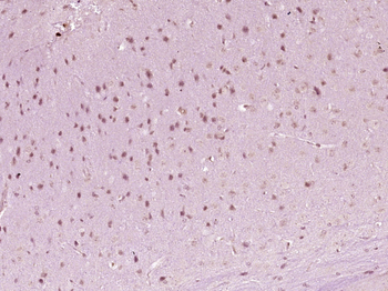 HOXA6 Rabbit Polyclonal Antibody