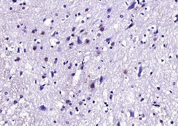 HOXA6 Rabbit Polyclonal Antibody