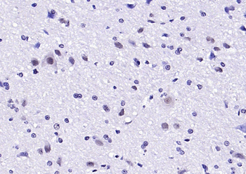 HOXA6 Rabbit Polyclonal Antibody