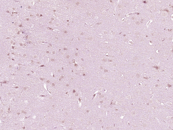 HOXA6 Rabbit Polyclonal Antibody