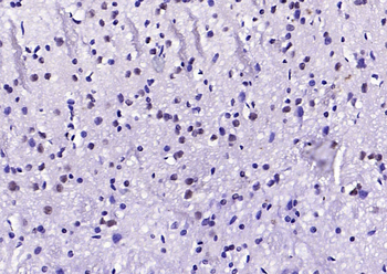 HOXA6 Rabbit Polyclonal Antibody