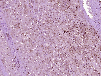 HOXA7 Rabbit Polyclonal Antibody