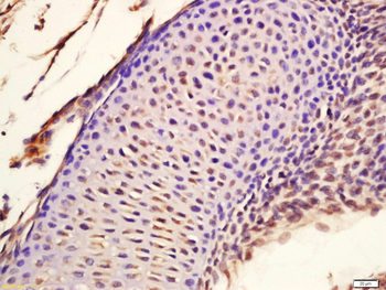 HOXA7 Rabbit Polyclonal Antibody