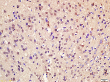 HOXA7 Rabbit Polyclonal Antibody