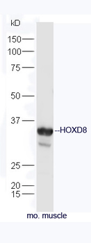 HOXD8 Rabbit Polyclonal Antibody