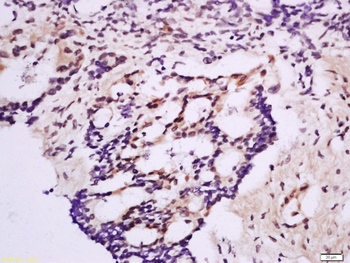 HOXD8 Rabbit Polyclonal Antibody