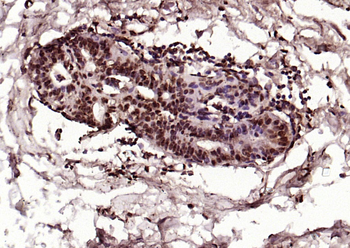 Phospho-HSP70 (Tyr611) Rabbit Polyclonal Antibody