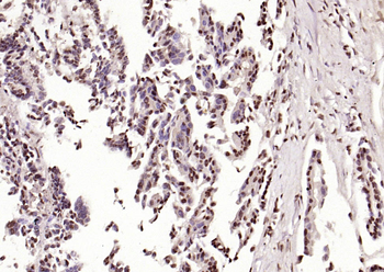 Phospho-HSP70 (Tyr611) Rabbit Polyclonal Antibody