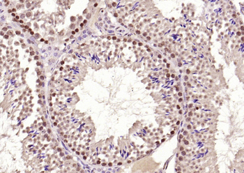 Phospho-HSP70 (Tyr611) Rabbit Polyclonal Antibody