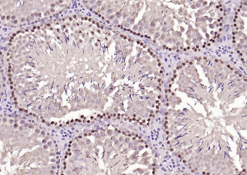 Phospho-HSP70 (Tyr611) Rabbit Polyclonal Antibody