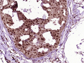 HSP70 Rabbit Polyclonal Antibody