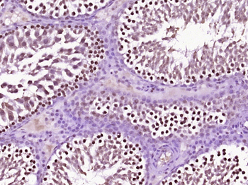 HSP70 Rabbit Polyclonal Antibody