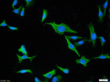 HSP70 Rabbit Polyclonal Antibody