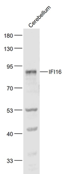 IFI16 Rabbit Polyclonal Antibody
