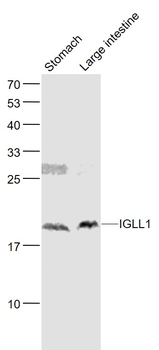IGLL1 Rabbit Polyclonal Antibody