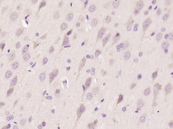 Phospho-IKB epsilon (Ser22) Rabbit Polyclonal Antibody