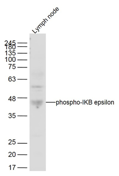 Phospho-IKB epsilon (Ser22) Rabbit Polyclonal Antibody