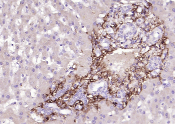 IKK Alpha + IKK beta Rabbit Polyclonal Antibody