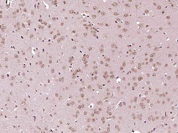 IKK Alpha + IKK beta Rabbit Polyclonal Antibody