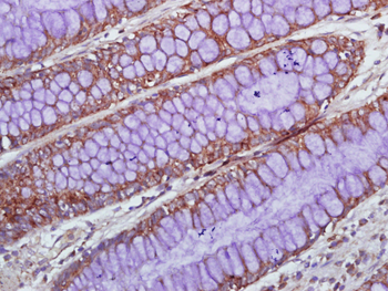 IL-1 Alpha Rabbit Polyclonal Antibody