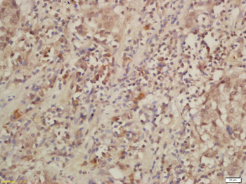 IL-28R Rabbit Polyclonal Antibody
