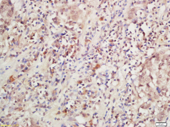 IL-28R Rabbit Polyclonal Antibody