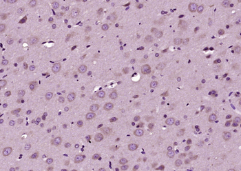 Inhibin Alpha Rabbit Polyclonal Antibody