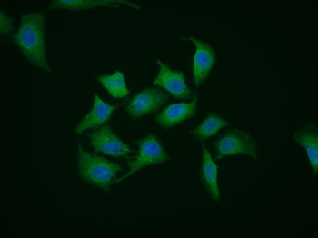 IP3 receptor Rabbit Polyclonal Antibody
