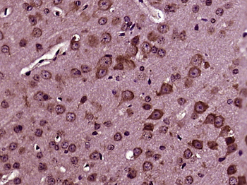 IQSEC2 Rabbit Polyclonal Antibody