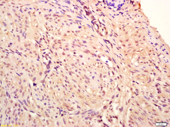 Phospho-IRAK1 (Thr209) Rabbit Polyclonal Antibody