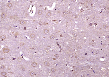 Phospho-IRE1a (Ser 726) Rabbit Polyclonal Antibody