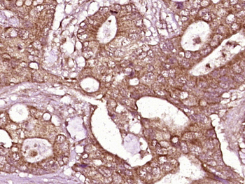 ITGB4/CD104 Rabbit Polyclonal Antibody