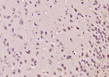 JLP/MAX binding protein Rabbit Polyclonal Antibody