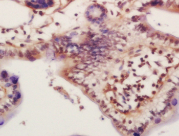 Phospho-KDM4B (Thr305) Rabbit Polyclonal Antibody