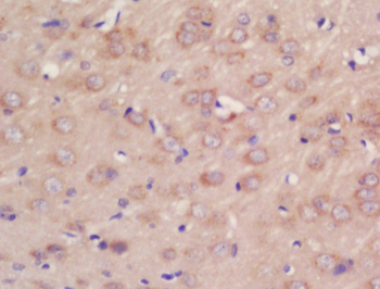 Phospho-KDM4B (Thr305) Rabbit Polyclonal Antibody