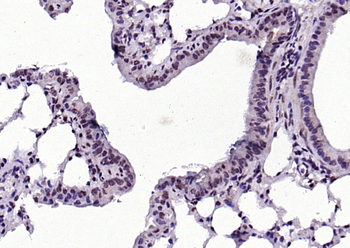 Phospho-JunB (Thr102 + Thr104) Rabbit Polyclonal Antibody