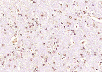 KAT5 / Tip60 Rabbit Polyclonal Antibody