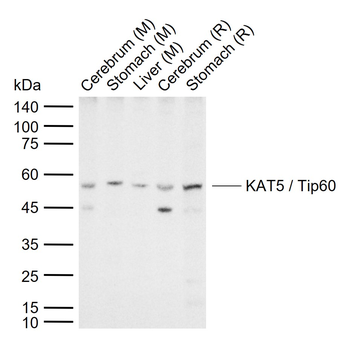 KAT5 / Tip60 Rabbit Polyclonal Antibody