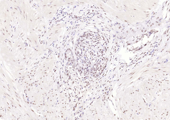 KIBRA Rabbit Polyclonal Antibody