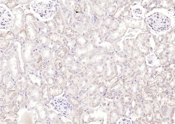 KIBRA Rabbit Polyclonal Antibody