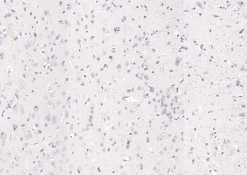 KIBRA Rabbit Polyclonal Antibody