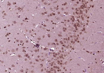 KIBRA Rabbit Polyclonal Antibody