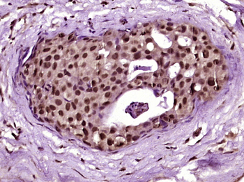 Kindlin 2 Rabbit Polyclonal Antibody