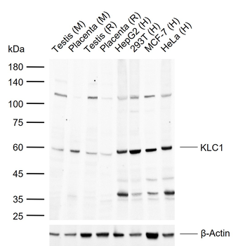 KLC1 Rabbit Polyclonal Antibody