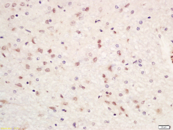 SETDB1/KMT1E Rabbit Polyclonal Antibody